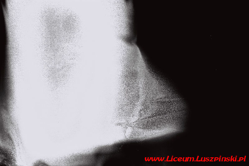 www.Liceum.Luszpinski.pl_1978-1982_1030